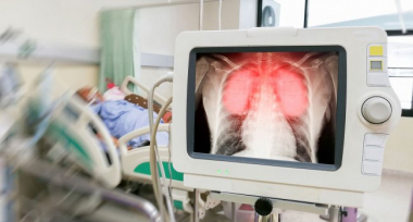 Ի՞նչ երկարաժամկետ առողջական խնդիրներ կարող է առաջացնել կորոնավիրուսը