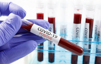 Կորոնավիրուսից առողջացել և Գյումրու ինֆեկցիոն հիվանդանոցից մինչ օրս դուրս է գրվել Շիրակի մարզի 454 բնակիչ