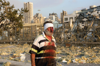 Առողջապահության համաշխարհային կազմակերպությունը դեղորայք ու վիրահատական սարքավորումներ է ուղարկում Լիբանան