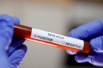 Վրաստանում 1 օրում գրանցվել է կորոնավիրուսով վարակման 9 նոր դեպք, ևս 13 մարդ առողջացել է