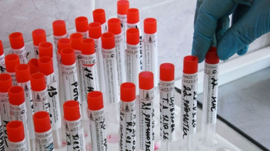 Հայաստանում հաստատվել է կորոնավիրուսով վարակվելու 1703 նոր դեպք. մահացել է 39 մարդ