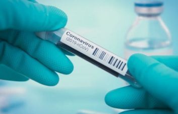  Հաստատվել է կորոնավիրուսային հիվանդության 485 նոր դեպք, մահացել է 10-ը մարդ