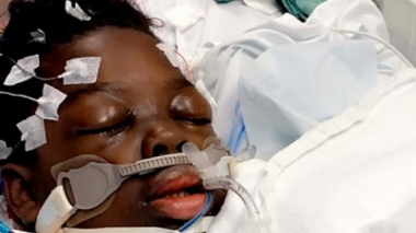 COVID-19-ի հազվագյուտ բարդության պատճառով ստիպված կլինեն տղայի ոտքերն անդամահատել