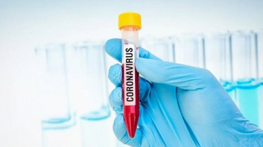 Արցախում 50 թեստավորման արդյունքում կորոնավիրուսի վարակի 1 դեպք է հայտնաբերվել