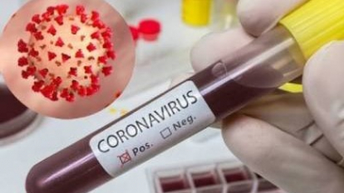 Հայաստանում հաստատվել է կորոնավիրուսով վարակվելու 283 նոր դեպք. մահացել է 8 մարդ