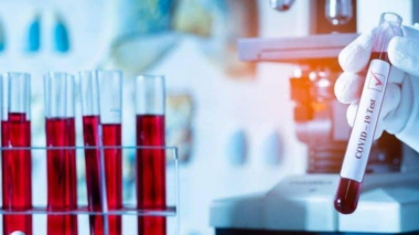 Արցախում կորոնավիրուսային հիվանդության նոր դեպք չի հաստատվել