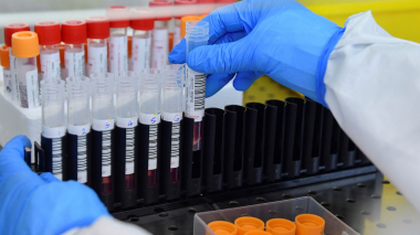 Իտալիայում կորոնավիրուսի՝ պատվաստանյութերի նկատմամբ կայուն մուտացիա են հայտնաբերել