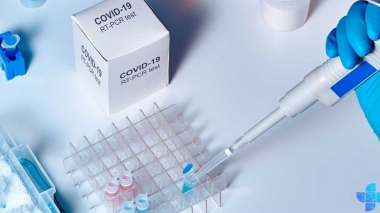 Հայաստանում հաստատվել է կորոնավիրուսի 1094 նոր դեպք, 21 մարդ մահացել է