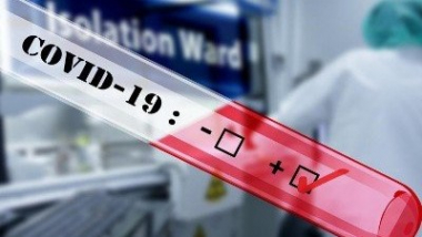 Հայաստանում հաստատվել է կորոնավիրուսով վարակվելու 510 նոր դեպք, մահացել է 19 մարդ