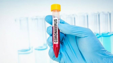 Արցախում կորոնավիրուսային հիվանդության 9 նոր դեպք է հաստատվել