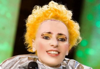 Ժաննա Ագուզարովան անճանաչելի է դարձել. Հիմա հաստատ այլմոլորակային է. լուսանկարներ