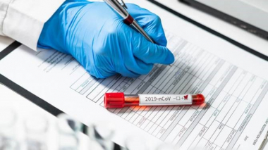 Արցախում հաստատվել է կորոնավիրուսի 7 նոր դեպք