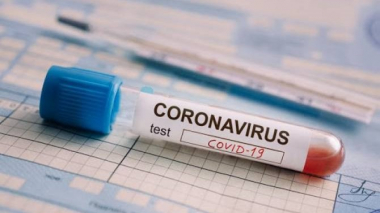 Արցախում հաստատվել է կորոնավիրուսի երեք դեպք