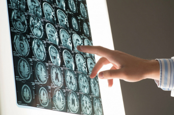 «Հավանայի համախտանիշի» հնարավոր ախտանիշներով 200 նոր դեպք է հայտնաբերվել