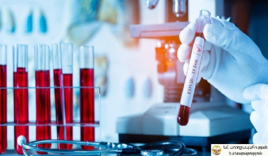 Արցախում հաստատվել է կորոնավիրուսային հիվանդության 4 դեպք