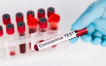 Արցախում Covid-19-ով վարակման ևս 2 դեպք է գրանցվել