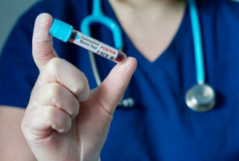 ՀՀ-ում արձանագրվել է կորոնավիրուսային հիվանդության 296 նոր դեպք, 16 մահ