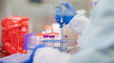 Հաստատվել է կորոնավիրուսով վարակվելու 1331 նոր դեպք. մահացել է 30 մարդ