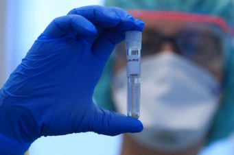 Արցախում կորոնավիրուսով վարակման 71 նոր դեպք է գրանցվել