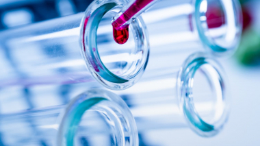 Վերջին 24 ժամվա ընթացքում Վրաստանում կորոնավիրուսից մահացել է 49 պացիենտ