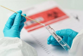 Նախարարը հիշեցնում է՝ կորոնավիրուսի ախտանշան ունենալու դեպքում կարելի է պոլիկլինիկայում անվճար թեստավորվել