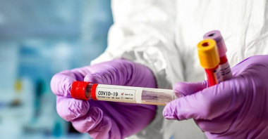 Արցախում կորոնավիրուսային հիվանդության 31 նոր դեպք է գրանցվել