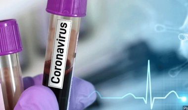 Վրաստանում արձանագրվել է կորոնավիրուսով վարակման 3 123 նոր դեպք