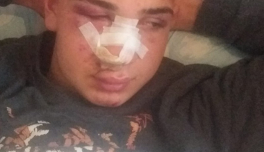 Թուրքիայում ռասիստները դաժանաբար ծեծել են քուրդ երիտասարդի