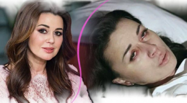 Առավելագույնը մեկ-երկու ամիս». ուռուցքաբան Յուրի Պոկրովսկին Զավորոտնյուկի ընտանիքին հորդորել է պատրաստվել վատթարագույնին. լուսանկարներ