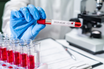 Իրանում հայտնաբերվել է կորոնավիրուսի 1084 նոր դեպք. մահացել է 4 քաղաքացի