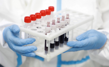 Օգոստոսի 1-7-ը հաստատվել է կորոնավիրուսի 1849 նոր դեպք