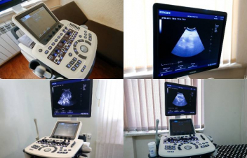 Համայնքային ենթակայության 8 բուժհաստատություն համալրվել է ուլտրաձայնային ստացիոնար հետազոտության սարքավորումներով