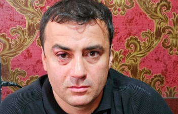 Արթուր Չախոյանը ձերբակալվել է, սակայն հիվանդանոցում է