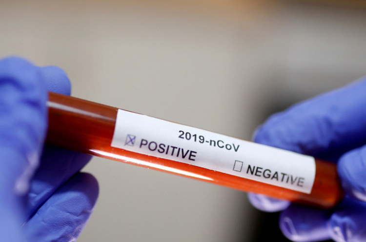 Վրաստանում մեկ օրվա ընթացքում գրանցվել է կորոնավիրուսով վարակման 24 նոր դեպք