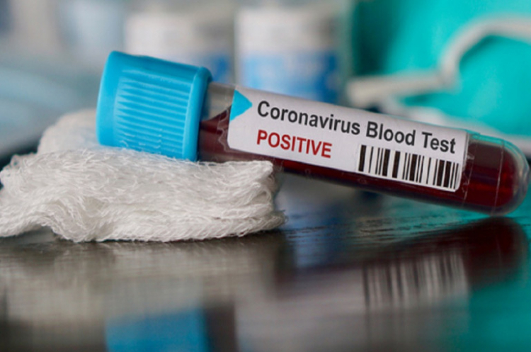 Վրաստանում վերջին 1 օրում գրանցվել է կորոնավիրուսով վարակման 14 նոր դեպք, ևս 44 մարդ առողջացել է