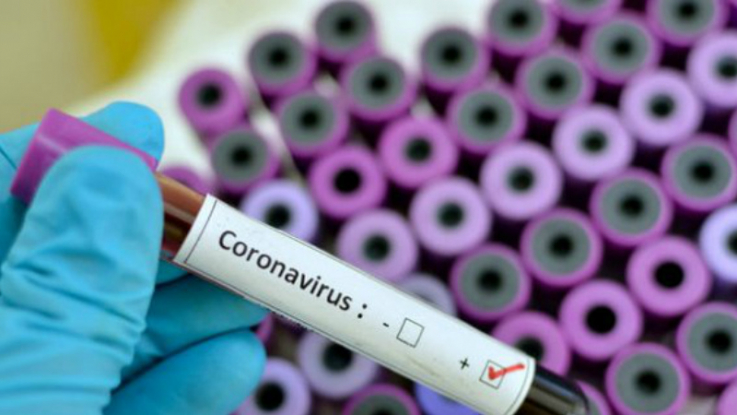 Հայաստանում հաստատվել է կորոնավիրուսային հիվանդության 978 նոր դեպք