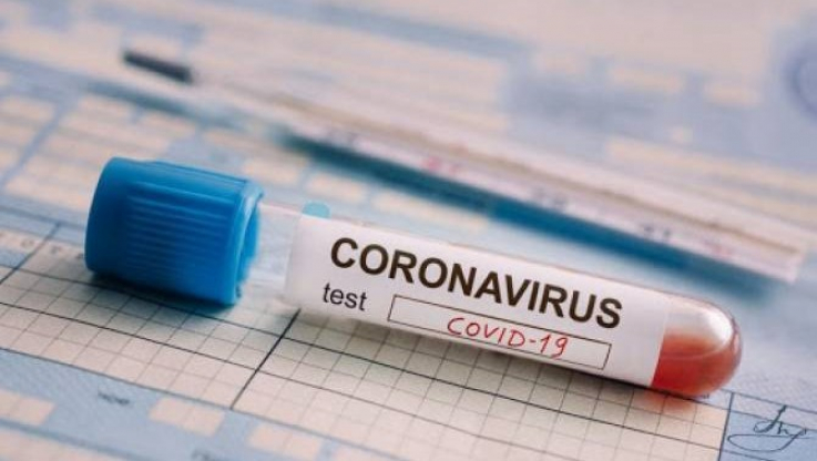 Արցախում կորոնավիրուսով վարակված 40 հիվանդ ստացիոնար բուժում է ստանում