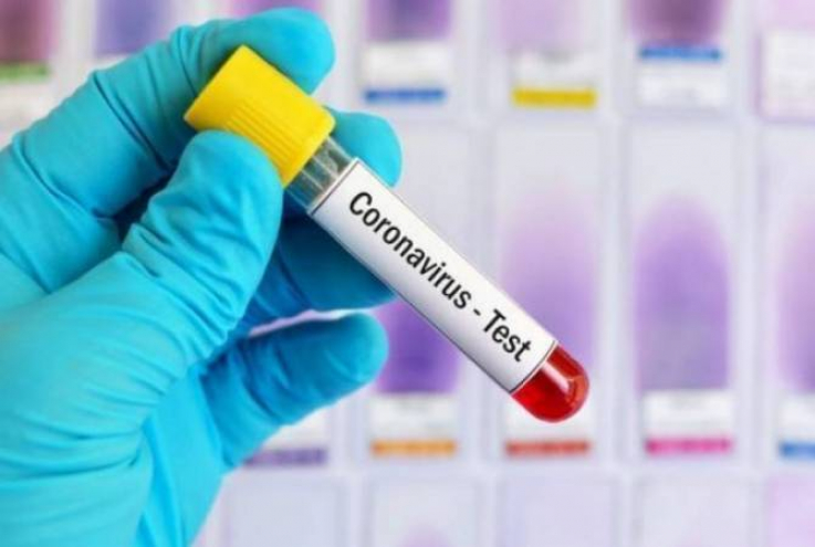 Արցախում կորոնավիրուսային հիվանդության դեպքեր չեն հայտնաբերվել
