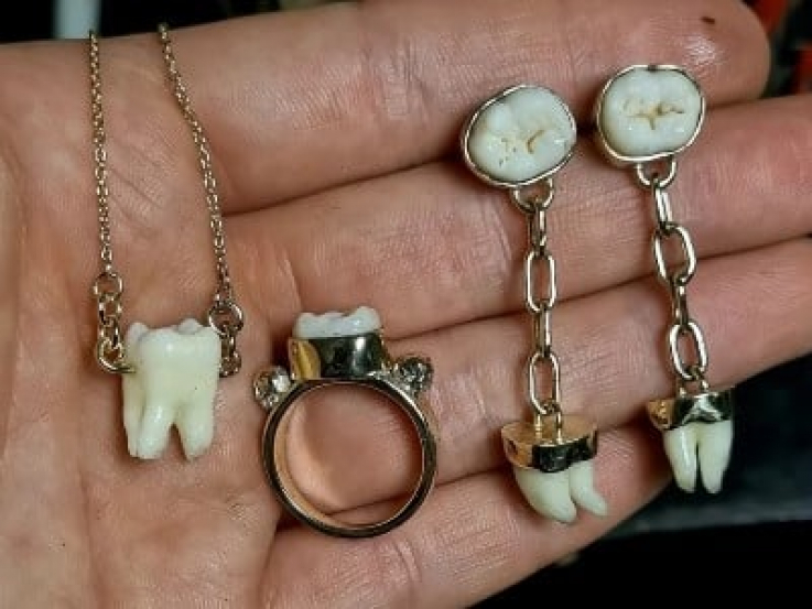 Ատամներից զարդեր. սիրելիներին հիշելու նոր սահմռկեցուցիչ միջոց
