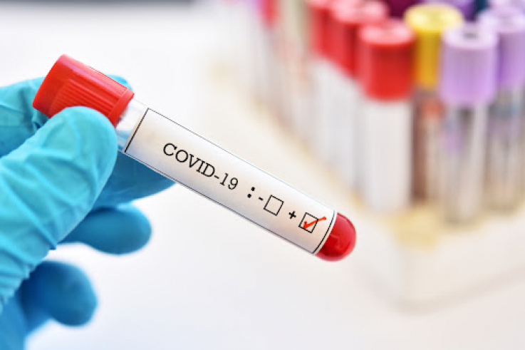 Գիտնականները որոշ հիվանդների մոտ հայտնաբերել են COVID-19- ի ասիմպտոմատիկ ընթացքի պատճառը