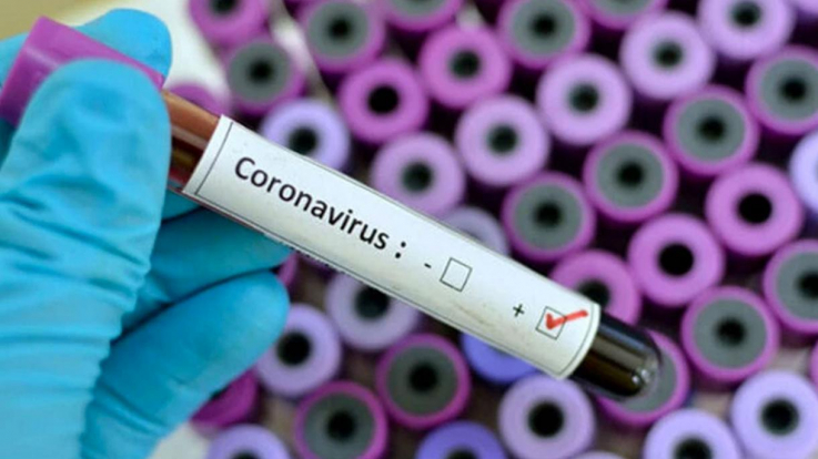 Աշխարհում մեկ շաբաթվա ընթացքում ավելի քան 3,6 միլիոն մարդ վարակվել է կորոնավիրուսով