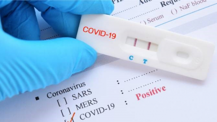 Արցախում հաստատվել է COVID-19-ի 4 նոր դեպք. կա 3 ծանր հիվանդ