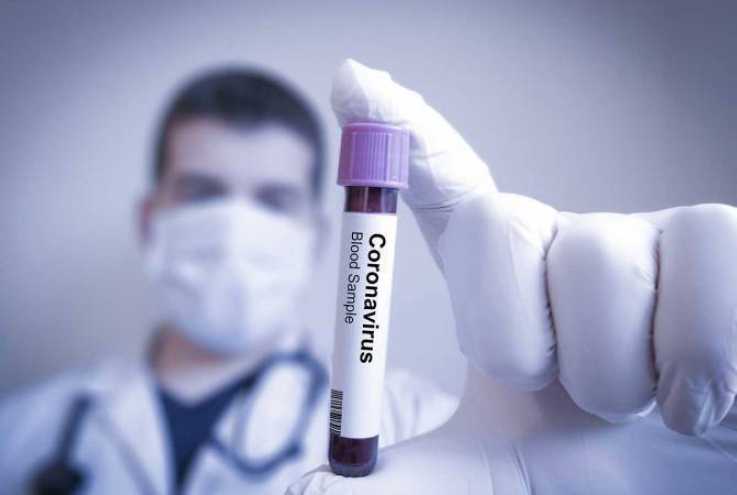 Արցախում արձանագրվել է կորոնավիրուսային հիվանդության 10 նոր դեպք