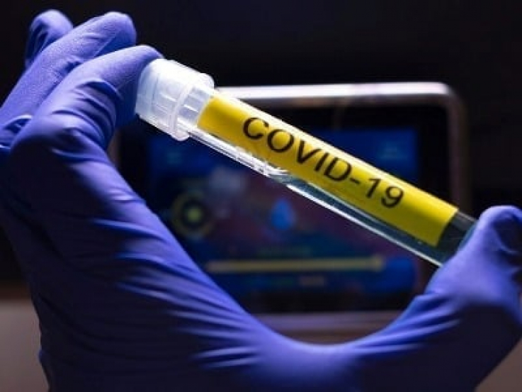Արցախում կորոնավիրուսի 314 նոր դեպք է գրանցվել, 4 հիվանդ մահացել է
