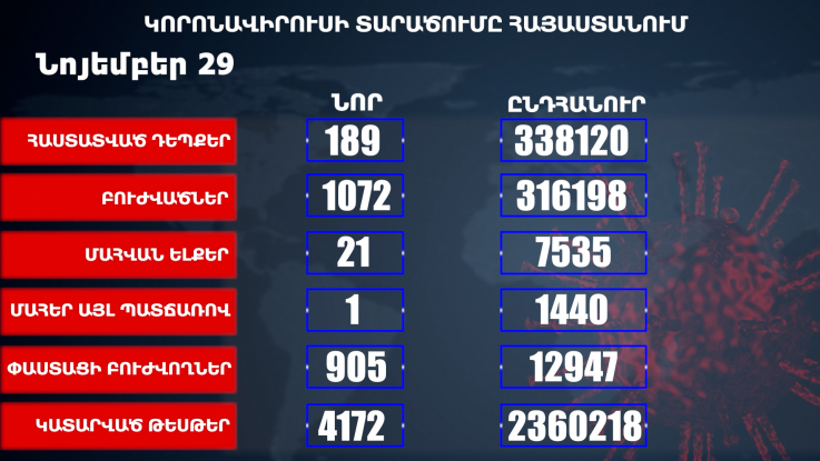 Հաստատվել է կորոնավիրուսի 189 նոր դեպք, առողջացել 1072 քաղաքացի