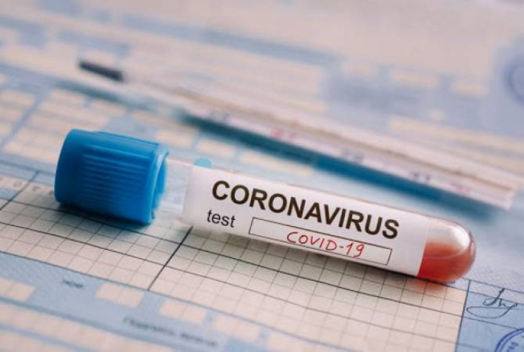 Արցախում hաստատվել են կորոնավիրուսային հիվանդության 63 նոր դեպքեր, մահացել է 4 քաղաքացի