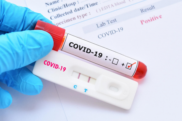 Չինաստանում գրանցվել է COVID-19-ի դեպքերի ամենամեծ թիվը 2020 թվականի փետրվարից ի վեր