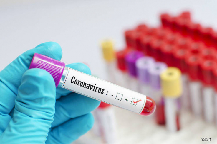 Մեկ շաբաթում գրանցվել է կորոնավիրուսի 174 նոր դեպք