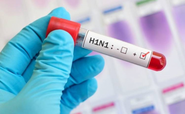 Հայաստանում  H1N1-ից 2 մարդ է մահացել